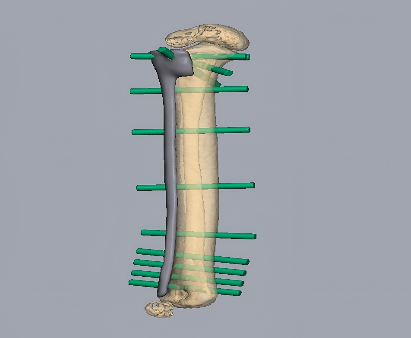 Biological Reconstruction
