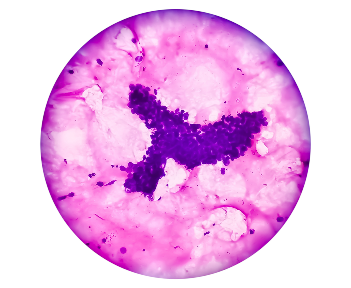 Skin and Adnexal Tumor Treatment